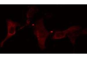 ABIN6278644 staining HuvEc cells by IF/ICC. (TMPRSS3 antibody  (Internal Region))