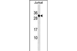 Western blot analysis in Jurkat cell line lysates (35ug/lane). (HLA-DMB antibody  (AA 127-154))