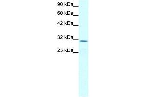 Human Jurkat; WB Suggested Anti-CLDN17 Antibody Titration: 2. (Claudin 17 antibody  (Middle Region))