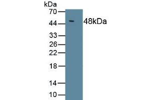 Detection of Recombinant IL10, Chicken using Polyclonal Antibody to Interleukin 10 (IL10) (IL-10 antibody  (AA 22-175))