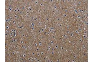 The image on the left is immunohistochemistry of paraffin-embedded Human brain tissue using ABIN7129632(GNG2 Antibody) at dilution 1/60, on the right is treated with fusion protein. (GNG2 antibody)