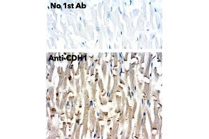 Immunohistochemistry (IHC) image for anti-Cadherin 1, Type 1, E-Cadherin (Epithelial) (CDH1) antibody (ABIN1440031) (E-cadherin antibody)