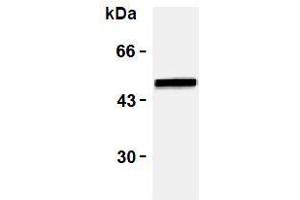 Western Blotting (WB) image for anti-Vimentin (VIM) antibody (ABIN1109484) (Vimentin antibody)