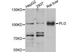 Western blot analysis of extracts of various cell lines, using PLG antibody (ABIN5971711) at 1/1000 dilution. (PLG antibody)