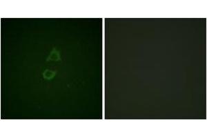 Immunofluorescence analysis of A549 cells, using Vinculin (Ab-821) Antibody. (Vinculin antibody  (AA 786-835))