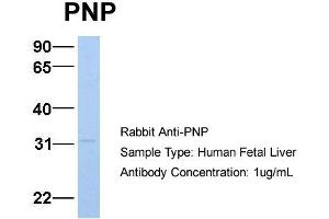 Host:  Rabbit  Target Name:  PNP  Sample Type:  Human Fetal Liver  Antibody Dilution:  1. (NP (Middle Region) antibody)