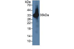 WB of Protein Standard: different control antibodies against Highly purified E. (CCL7 ELISA Kit)