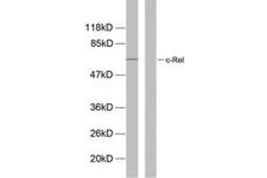 Western blot analysis of extracts from MDA-MB-435 cells, using Rel (Phospho-Ser503) Antibody. (c-Rel antibody  (pSer503))