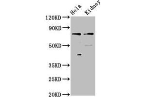 Western Blot Positive WB detected in: Hela whole cell lysate, Rat kidney tissue All lanes: CLCNKB antibody at 3 μg/mL Secondary Goat polyclonal to rabbit IgG at 1/50000 dilution Predicted band size: 76, 57 kDa Observed band size: 76 kDa (CLCNKB antibody  (AA 538-687))