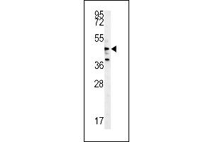 NLK- (ABIN652357 and ABIN2841643) western blot analysis in Y79 cell line lysates (35 μg/lane). (Nemo-Like Kinase antibody  (AA 275-300))