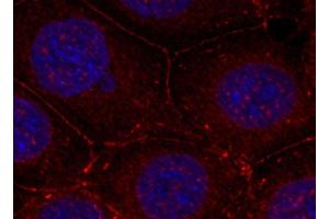 Immunofluorescence analysis of methanol-fixed MCF-7 cells using Phospho-IGF1R(Y1161) Polyclonal Antibody (IGF1R antibody  (pTyr1161))