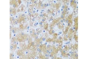 Immunohistochemistry of paraffin-embedded Human liver using ASB4 Polyclonal Antibody at dilution of 1:100 (40x lens). (ASB4 antibody)