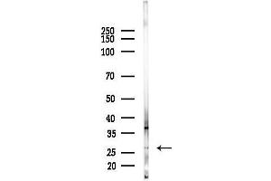 anti-Fibroblast Growth Factor Binding Protein 3 (FGFBP3) (C-Term) antibody