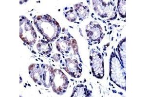 G3BP1 antibody immunohistochemistry analysis in formalin fixed and paraffin embedded human stomach tissue. (G3BP1 antibody  (AA 401-430))