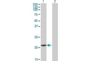 Western Blot analysis of MOBKL2C expression in transfected 293T cell line by MOBKL2C MaxPab polyclonal antibody.