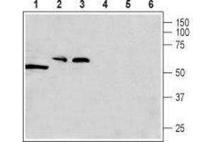 Western blot analysis of rat testis (lanes 1 and 4), rat brain (lanes 2 and 5) and mouse brain (lanes 3 and 6) lysates: - 1-3. (CACNG8 antibody  (Intracellular, N-Term))