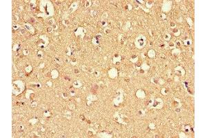 Immunohistochemistry (IHC) image for anti-DnaJ (Hsp40) Homolog, Subfamily C, Member 6 (DNAJC6) (AA 201-500) antibody (ABIN7166807)