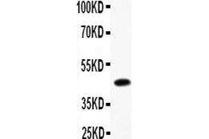 Western Blotting (WB) image for anti-B-cell antigen receptor complex-associated protein alpha chain (CD79A) (AA 121-226) antibody (ABIN3043397) (CD79a antibody  (AA 121-226))