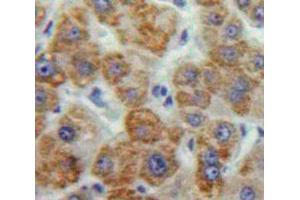 Used in DAB staining on fromalin fixed paraffin-embedded Liver tissue (MMP16 antibody  (AA 351-557))