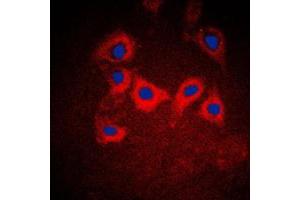 Immunofluorescent analysis of Cytokeratin 10 staining in A431 cells. (Keratin 10 antibody  (Center))