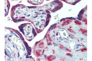 Placenta, Human: Formalin-Fixed, Paraffin-Embedded (FFPE) (PDIA4 antibody  (AA 623-638))