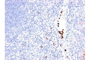 Image no. 1 for anti-Myeloid-Associated Differentiation Marker (MYADM) antibody (ABIN6188661) (MYADM antibody)