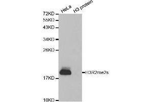 Western blot analysis of extracts of various cell lines, using Symmetric DiMethyl-Histone H3-R2 antibody. (Histone 3 antibody  (H3R2me2))