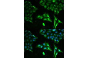 Immunofluorescence analysis of U20S cell using ACADS antibody. (ACADS antibody)