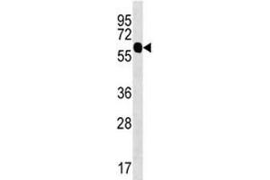 ZFP64 antibody western blot analysis in uterus tissue lysate (ZFP64 antibody  (AA 525-551))