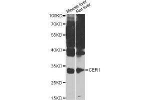 Western blot analysis of extracts of various cell lines, using CER1 Antibody (ABIN4903254) at 1:1000 dilution.