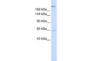 WB Suggested Anti-ATP10D Antibody Titration:  0. (ATP10D antibody  (C-Term))