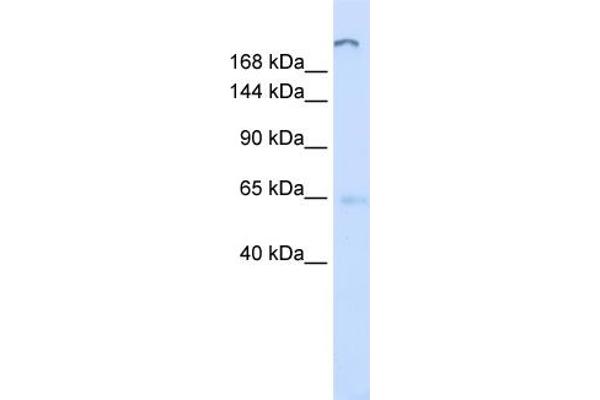 ATP10D Antikörper  (C-Term)