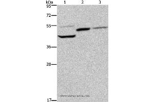 Western blot analysis of Mouse heart, kidney and liver tissue, using CYR61 Polyclonal Antibody at dilution of 1:350 (CYR61 antibody)