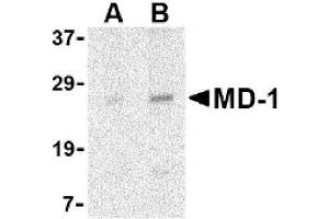 Image no. 1 for anti-Lymphocyte Antigen 86 (LY86) (Middle Region) antibody (ABIN265132) (LY86 antibody  (Middle Region))