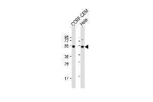 All lanes : Anti-TBB1 Antibody at 1:2000 dilution Lane 1: CCRF-CEM whole cell lysate Lane 2: Hela whole cell lysate Lysates/proteins at 20 μg per lane. (TUBB1 antibody)