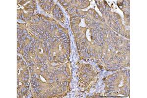 IHC analysis of MRPS22 using anti-MRPS22 antibody (ABIN7600613). (MRPS22 antibody  (AA 21-329))