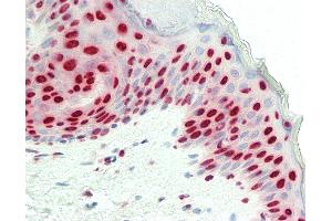 Anti-MATR3 / Matrin 3 antibody IHC staining of human skin. (MATR3 antibody  (C-Term))