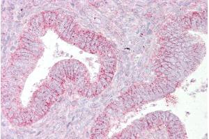 Immunohistochemistry with Uterus tissue at an antibody concentration of 5µg/ml using anti-SUFU antibody (ARP39233_P050) (SUFUH antibody  (Middle Region))