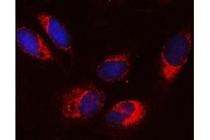 IF analysis of SRPRA using anti-SRPRA antibody (ABIN7601408). (SRPRA (AA 346-638) antibody)