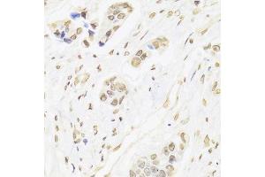 Immunohistochemistry (Paraffin-embedded Sections) (IHC (p)) image for anti-X-Ray Repair Complementing Defective Repair in Chinese Hamster Cells 6 (XRCC6) (AA 500-600) antibody (ABIN1513143)