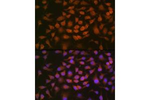 Immunofluorescence analysis of HeLa cells using GRK2 Rabbit mAb (ABIN7265504) at dilution of 1:100 (40x lens). (GRK2 antibody)