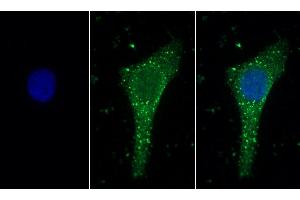 Detection of LAMA1 in Human Hela cell using Polyclonal Antibody to Laminin Alpha 1 (LAMA1) (Laminin alpha 1 antibody  (AA 886-1039))