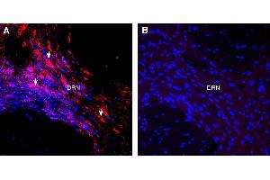 Expression of Orexin Receptor 1 in rat dorsal root nucleus (DRN).