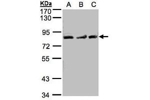 Image no. 1 for anti-MutL Homolog 1 (MLH1) (AA 373-735) antibody (ABIN467426) (MLH1 antibody  (AA 373-735))