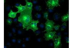 Immunofluorescence (IF) image for anti-Methylmalonic Aciduria (Cobalamin Deficiency) CblB Type (MMAB) antibody (ABIN1499509)