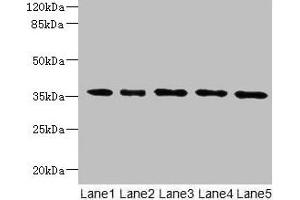 Western blot All lanes: OXNAD1 antibody at 4 μg/mL Lane 1: Mouse large intestine tissue Lane 2: Mouse lung tissue Lane 3: K562 whole cell lysate Lane 4: U251 whole cell lysate Lane 5: A549 whole cell lysate Secondary Goat polyclonal to rabbit IgG at 1/10000 dilution Predicted band size: 35 kDa Observed band size: 35 kDa