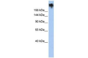 PKDREJ antibody used at 1 ug/ml to detect target protein. (PKDREJ antibody  (Middle Region))