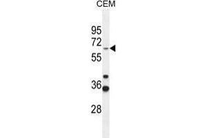 ZNF667 Antibody (Center) western blot analysis in CEM cell line lysates (35 µg/lane). (ZNF667 antibody  (Middle Region))