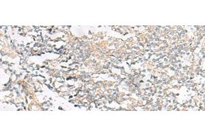 Immunohistochemistry of paraffin-embedded Human tonsil tissue using HELT Polyclonal Antibody at dilution of 1:40(x200) (HELT antibody)