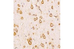 Immunohistochemistry analysis of paraffin-embedded human placenta using,CLIC6 (ABIN7073478) at dilution of 1: 600 (CLIC6 antibody)